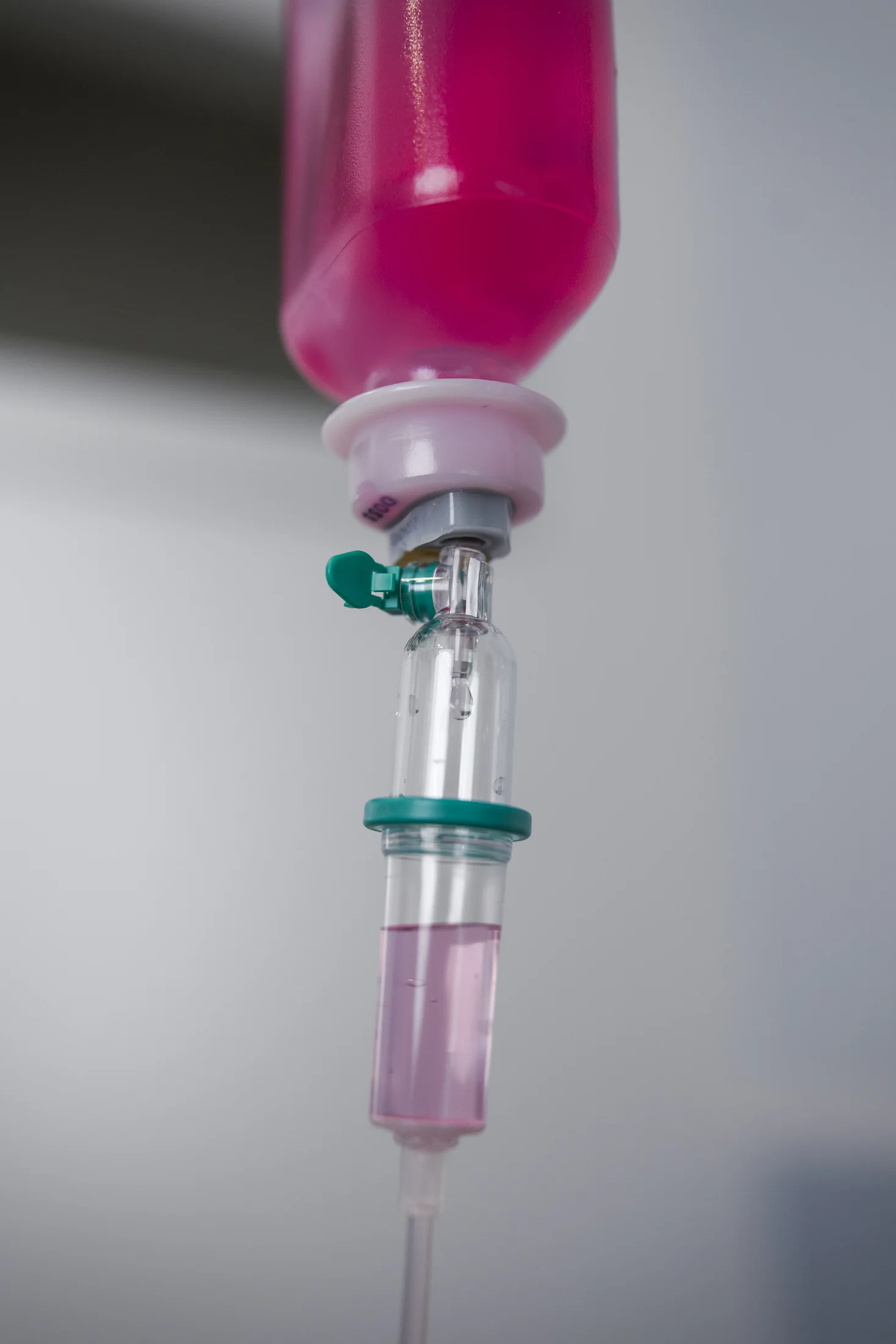 Zentrum für integrative Medizin Karlsruhe Eisenmangel Eiseninfusion